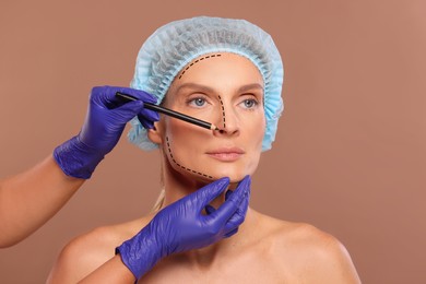 Woman preparing for cosmetic surgery, light brown background. Doctor drawing markings on her face, closeup