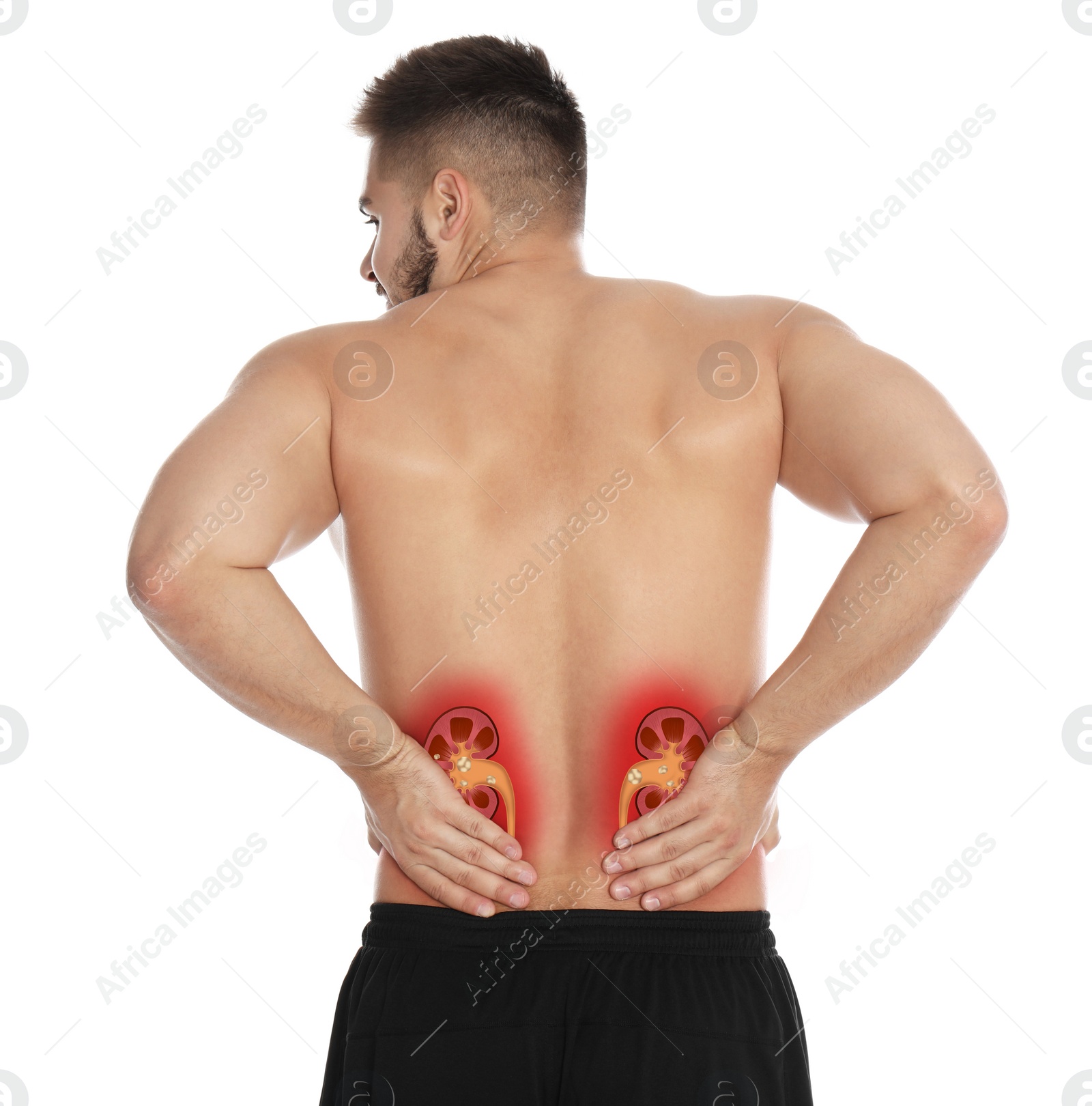 Image of Man suffering from pain because of kidney stones disease on white background