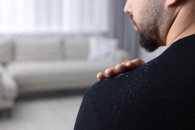 Man brushing dandruff off his sweater indoors, closeup. Space for text