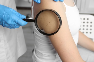 Dermatologist examining patient's birthmark with magnifying glass in clinic, closeup