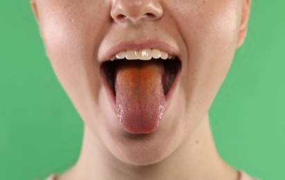 Photo of Gastrointestinal diseases. Woman showing her yellow tongue on green background, closeup