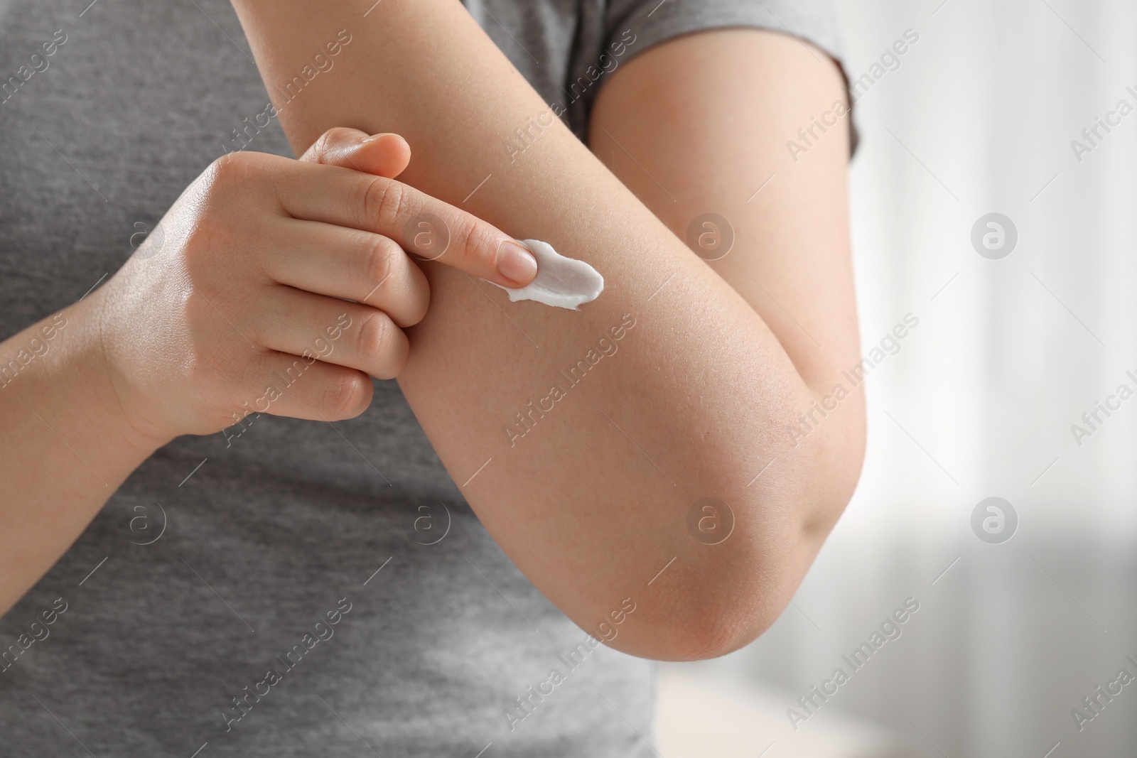 Photo of Woman applying ointment onto her arm indoors, closeup