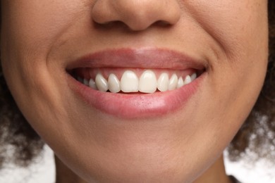 Photo of Woman with clean teeth smiling, closeup view