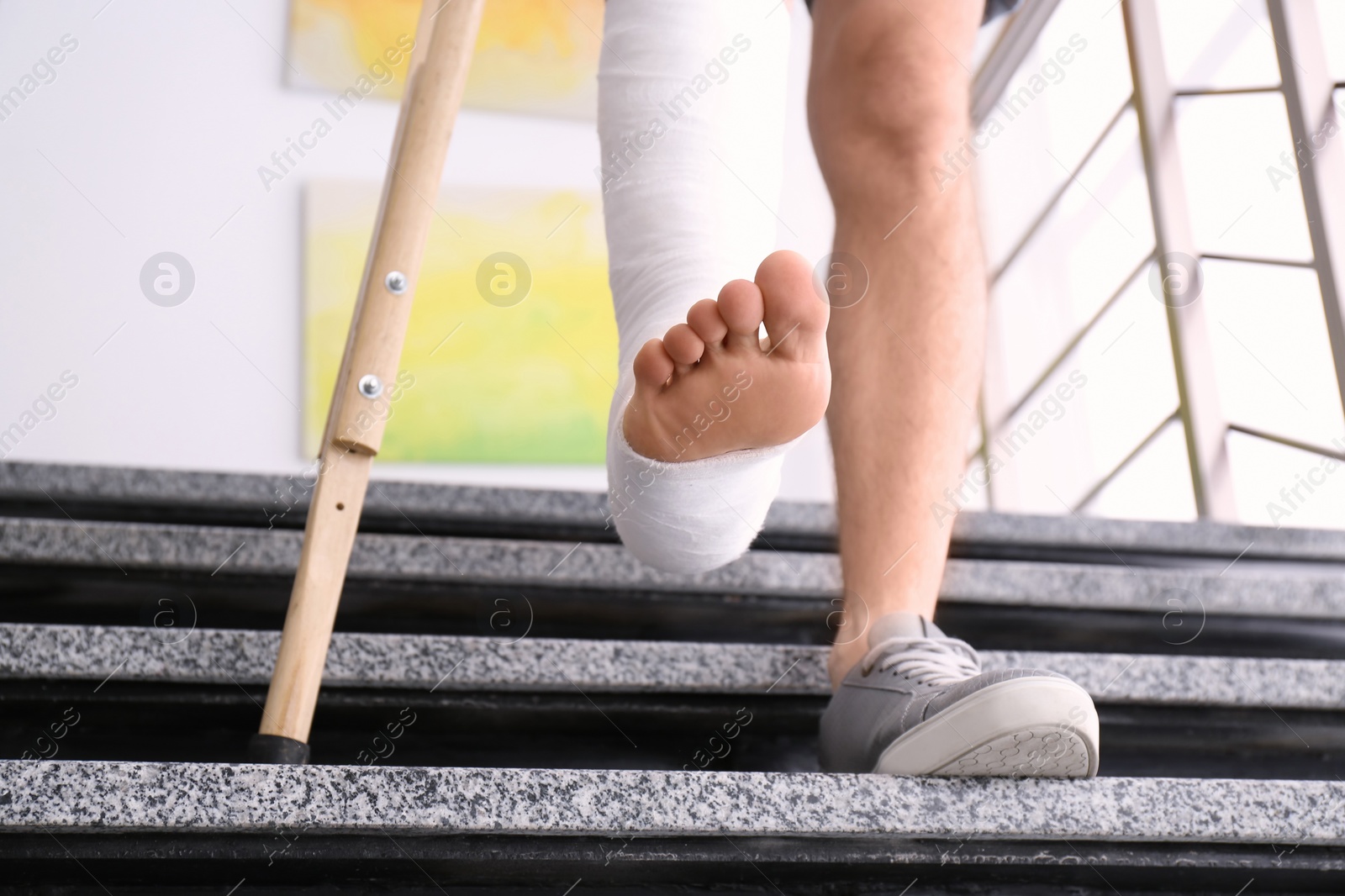 Photo of Young man with crutch and broken leg in cast on stairs