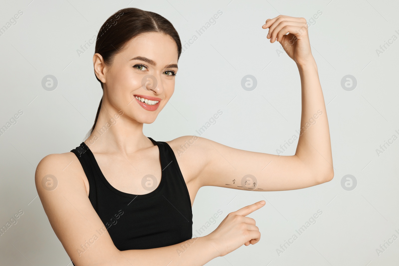 Photo of Slim young woman with marks on arm against light background. Weight loss surgery