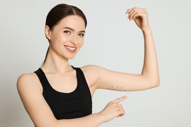 Photo of Slim young woman with marks on arm against light background. Weight loss surgery
