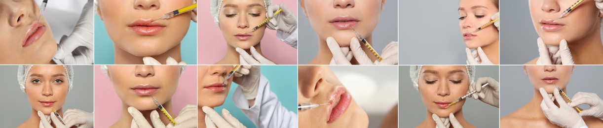 Image of Collage with photos of woman during lip augmentation procedure. Banner design