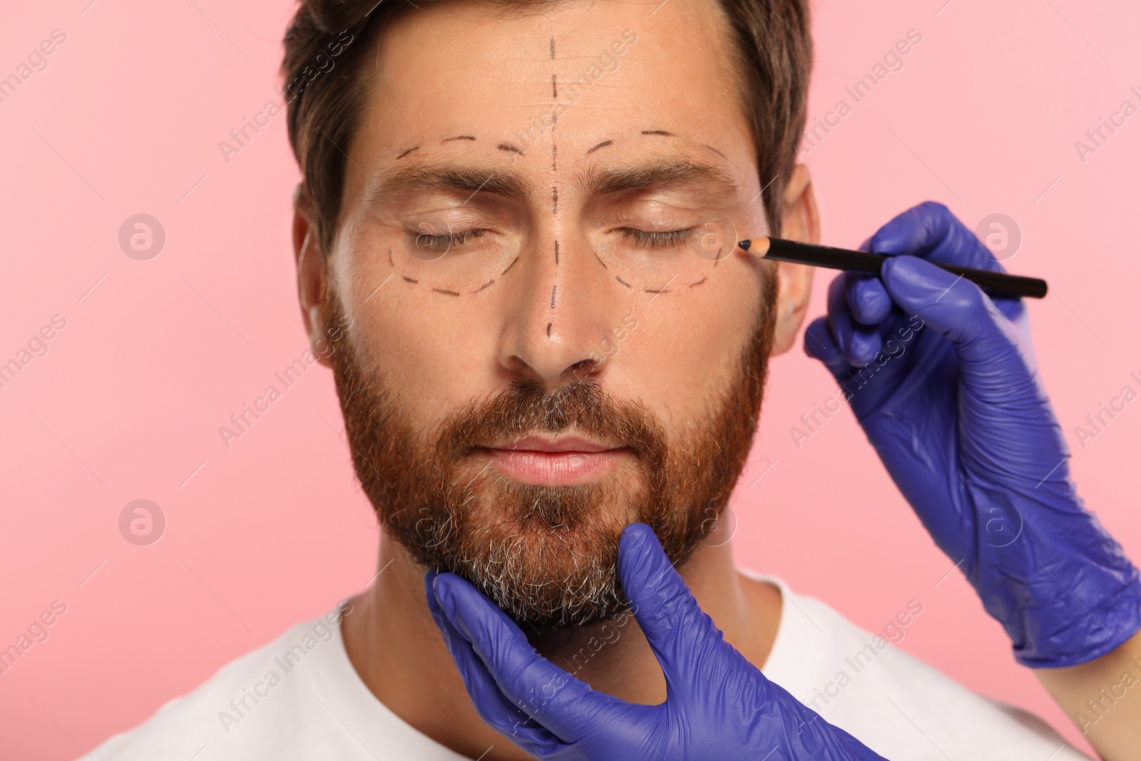 Photo of Doctor with pencil preparing patient for cosmetic surgery operation on pink background, closeup