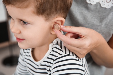 Young woman putting hearing aid in little son's ear indoors, closeup