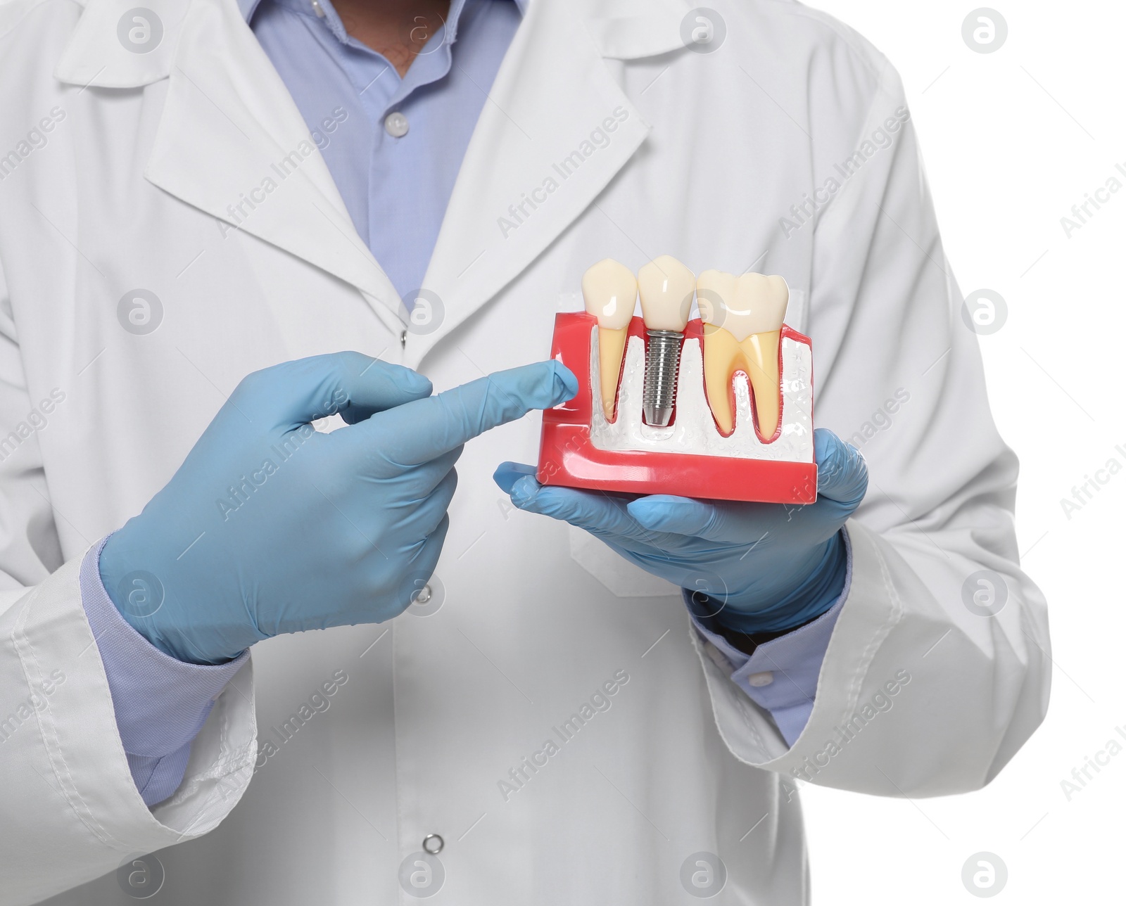 Photo of Dentist holding educational model of dental implant on white background, closeup