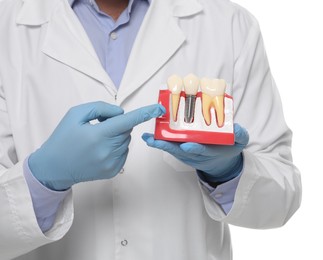 Dentist holding educational model of dental implant on white background, closeup