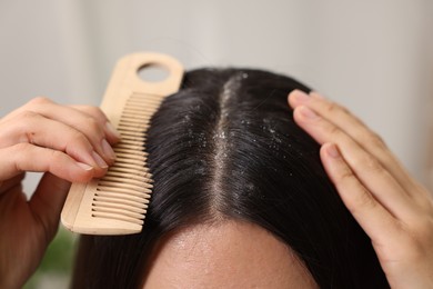 Photo of Woman with comb examining her hair and scalp on blurred background, closeup. Dandruff problem