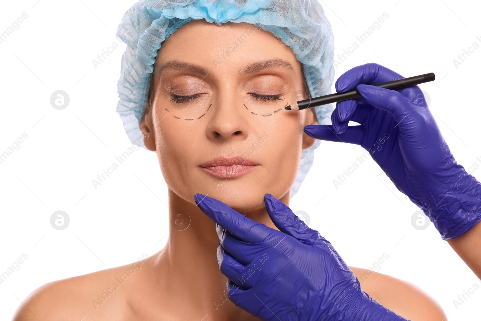 Photo of Doctor with pencil preparing patient for cosmetic surgery operation on white background, closeup