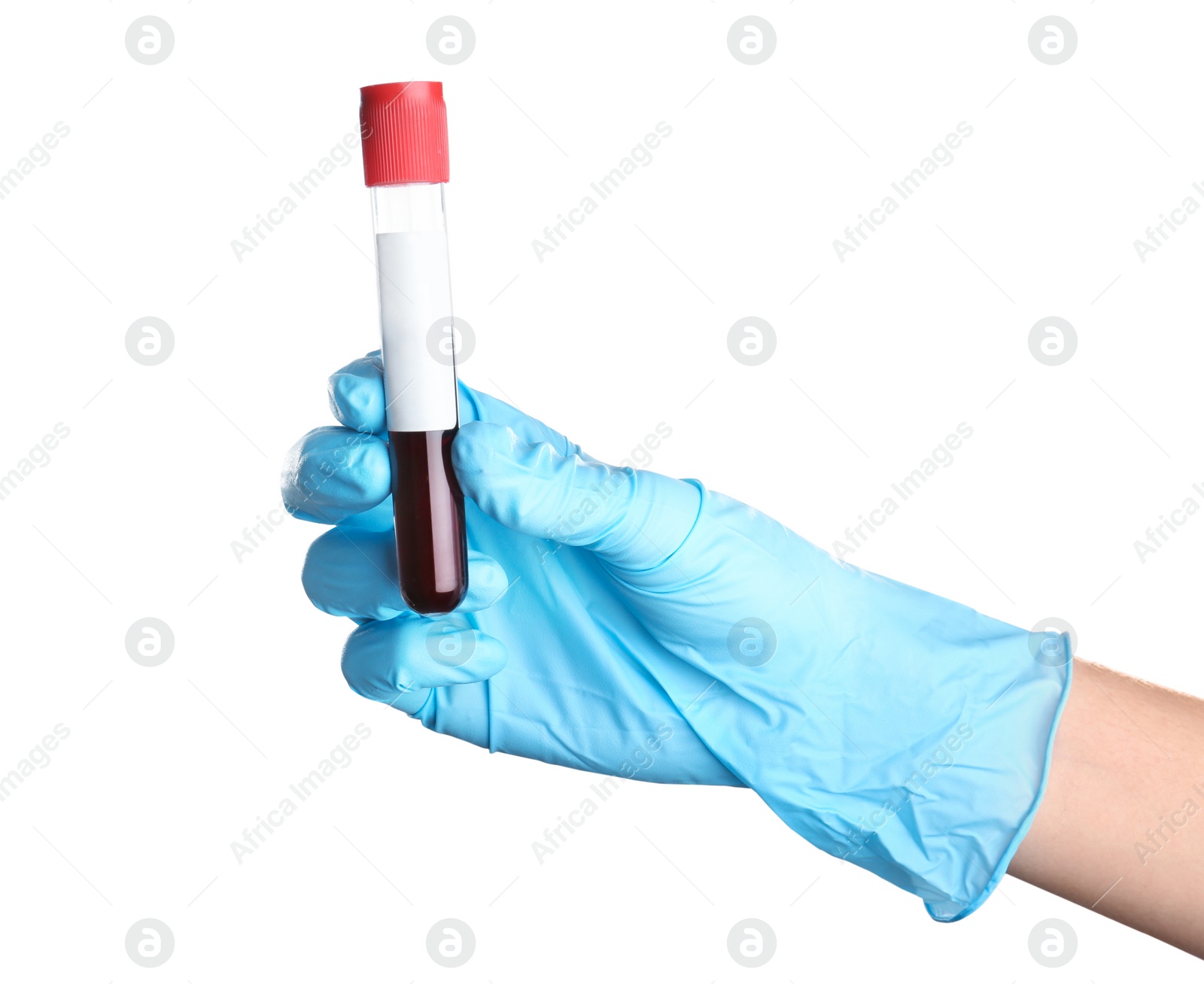 Photo of Doctor holding glass tube with blood on white background, closeup. Allergy test