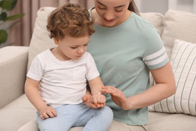 Photo of Mother applying ointment onto her son`s hand on sofa indoors
