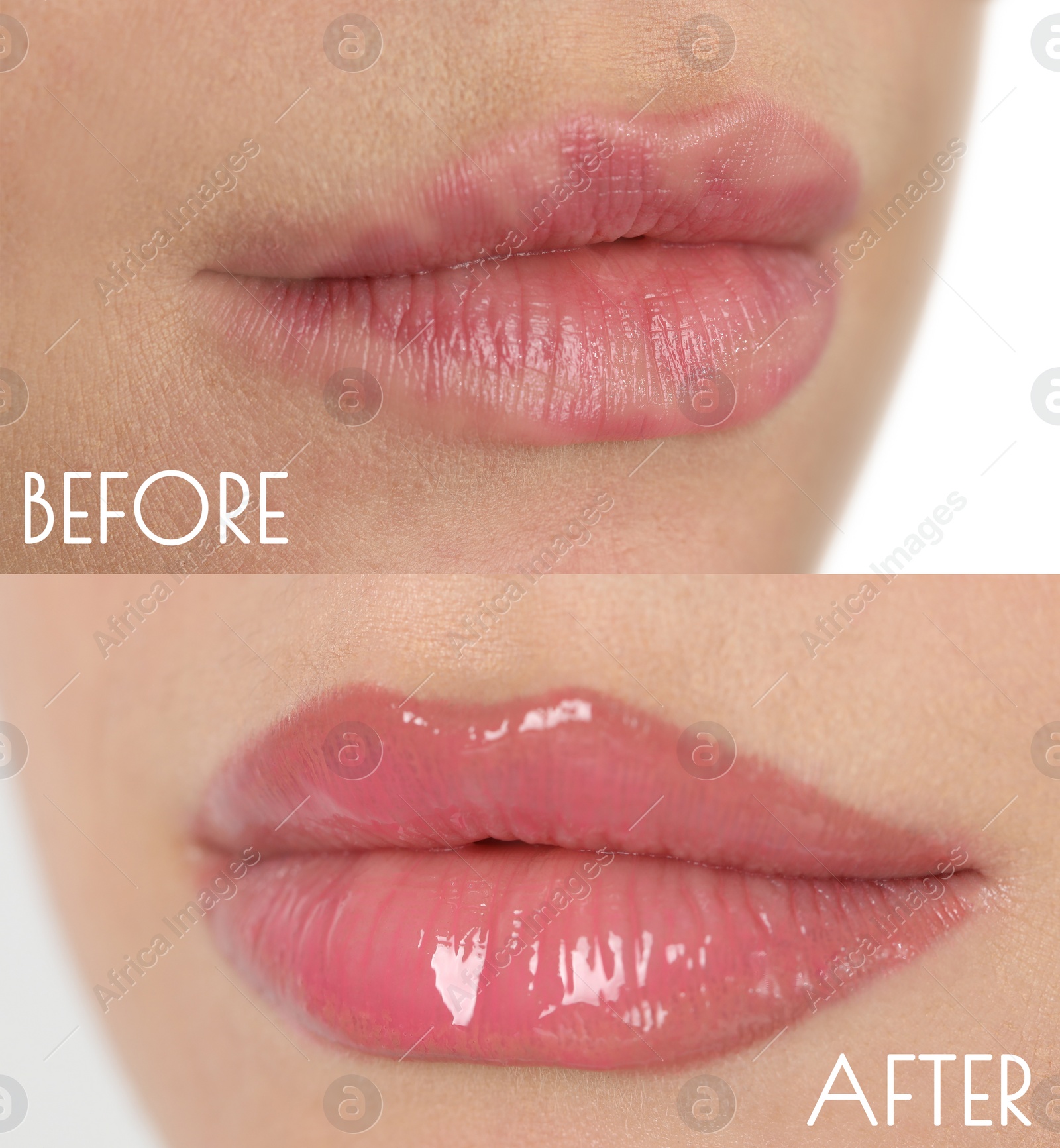 Image of Collage with photos of young woman before and after permanent lip makeup, closeup