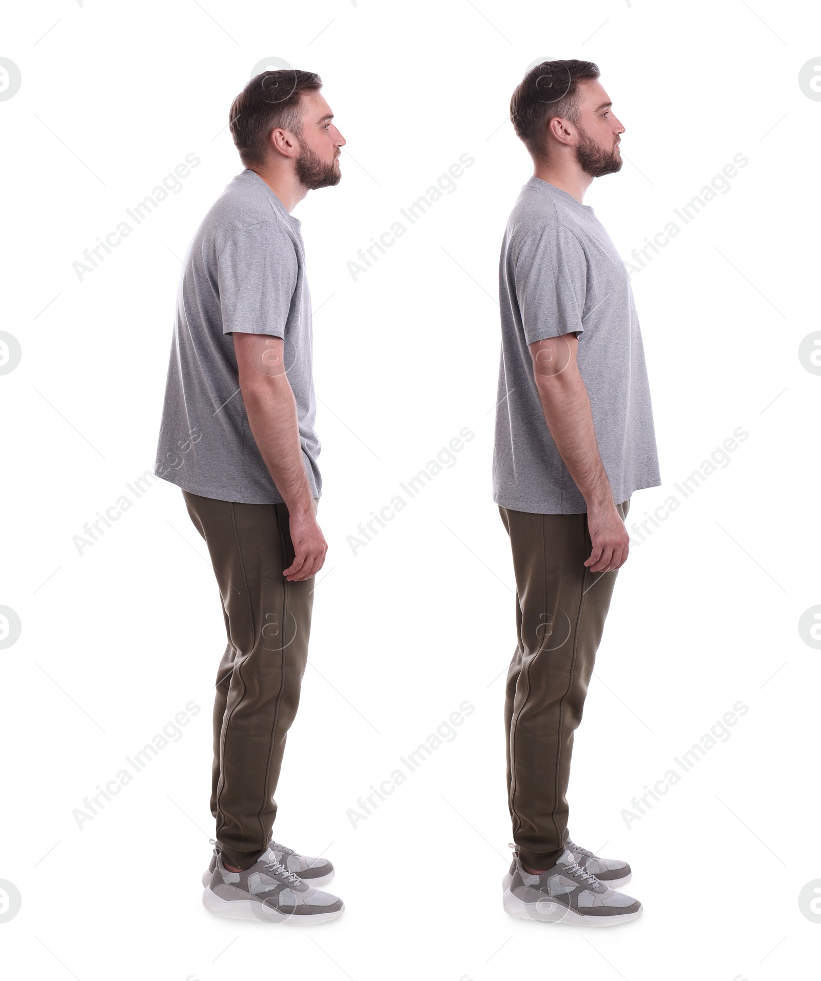 Image of Collage with photos of young man with poor and good posture on white background