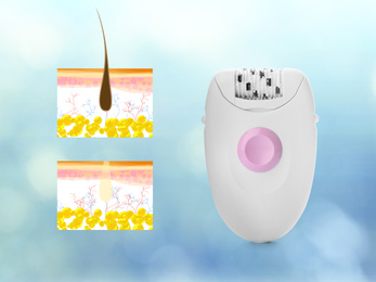 Image of Epilation procedure. Modern appliance and illustrations of hair follicle on light blue background