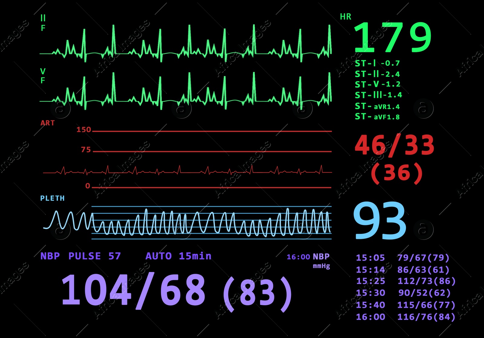 Illustration of Cardiogram and data on display of heart rate monitor. Illustration