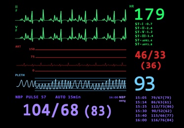 Illustration of Cardiogram and data on display of heart rate monitor. Illustration