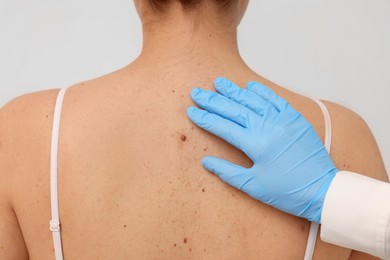 Dermatologist examining patient's birthmark on beige background, closeup