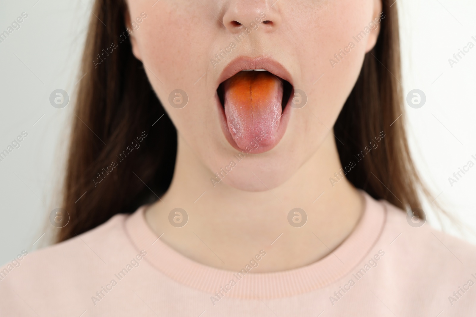 Photo of Gastrointestinal diseases. Woman showing her yellow tongue on white background, closeup