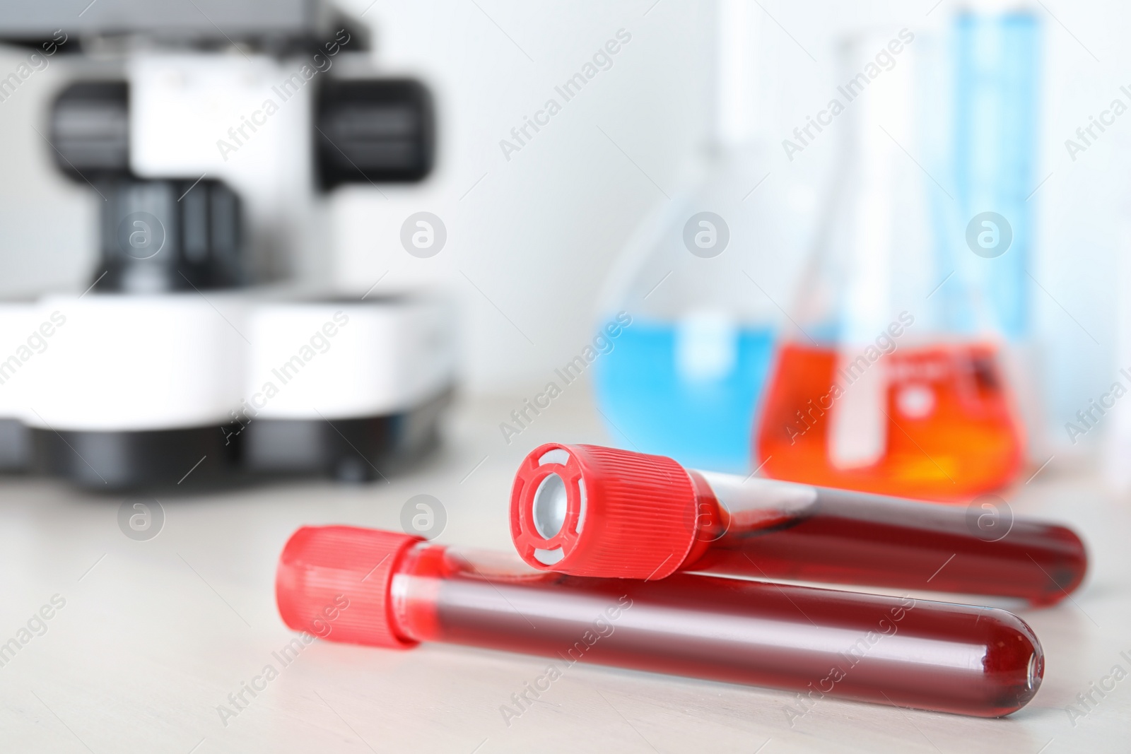 Image of Test tubes with blood samples on table. Laboratory analysis