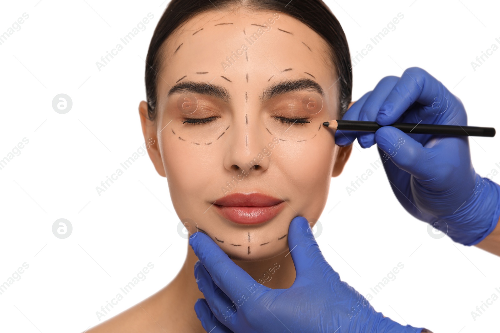 Photo of Doctor with pencil preparing patient for cosmetic surgery operation on white background, closeup