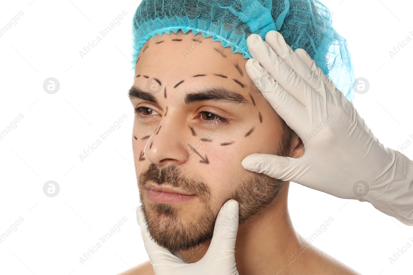 Photo of Doctor examining man's face with marker lines for plastic surgery operation on white background