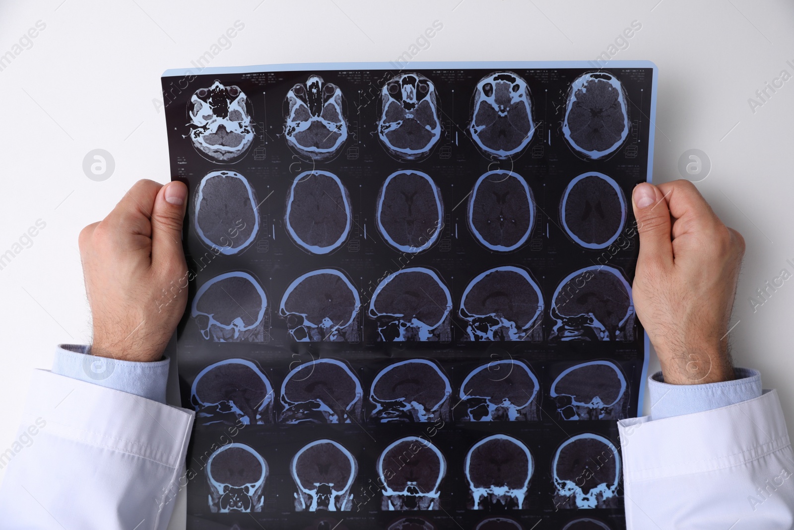 Photo of Doctor examining MRI images of patient with multiple sclerosis at white table, top view