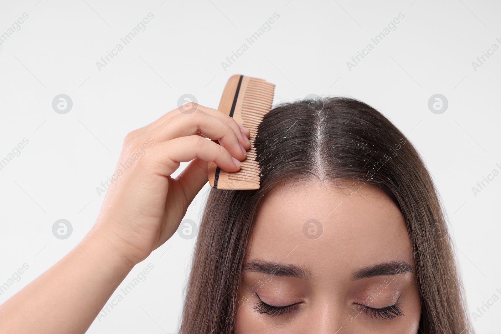 Photo of Woman with comb examining her hair and scalp on white background, closeup. Dandruff problem