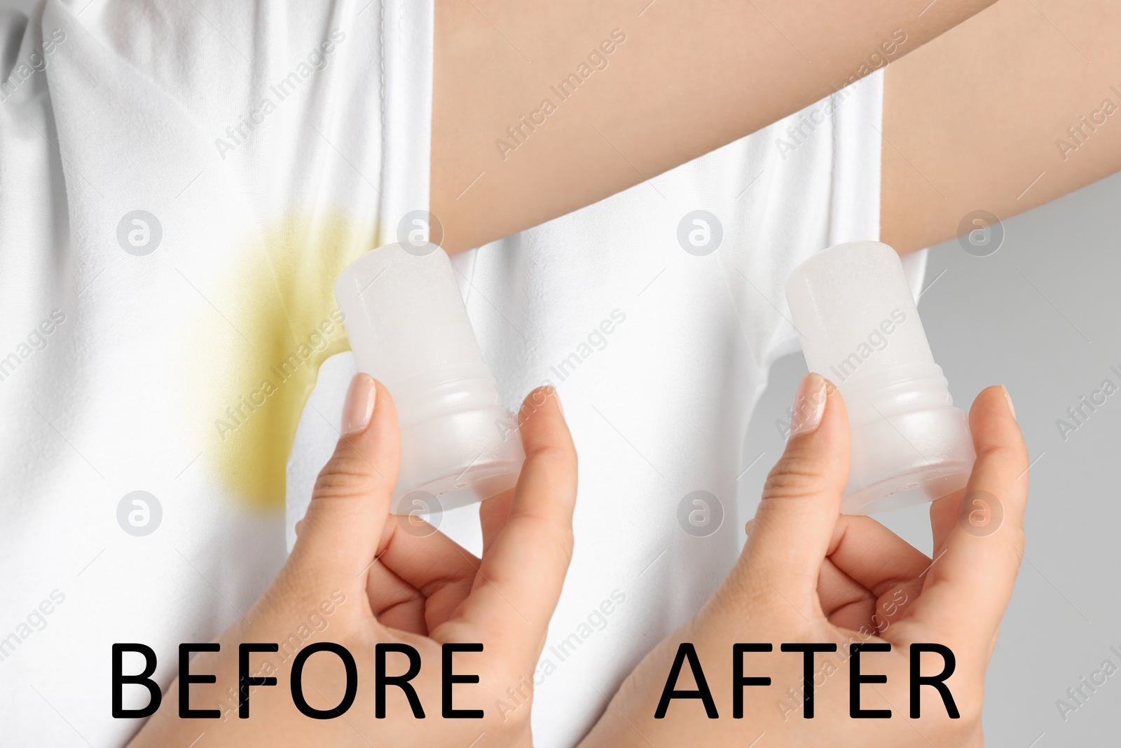 Image of Woman before and after using deodorant on light background, closeup