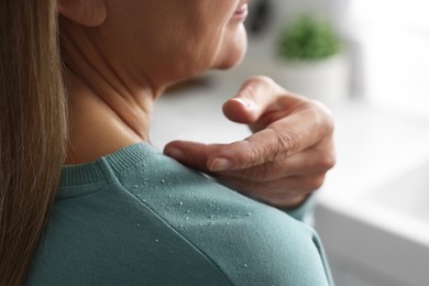 Photo of Woman brushing dandruff off her sweater indoors, closeup