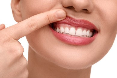 Woman showing her clean teeth on white background, closeup