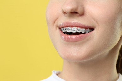 Photo of Smiling woman with dental braces on yellow background, closeup. Space for text