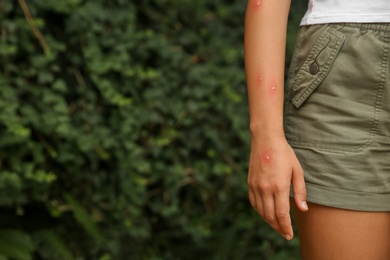 Photo of Woman with insect bites on arm in park, closeup. Space for text