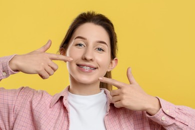 Photo of Portrait of smiling woman pointing at her dental braces on yellow background