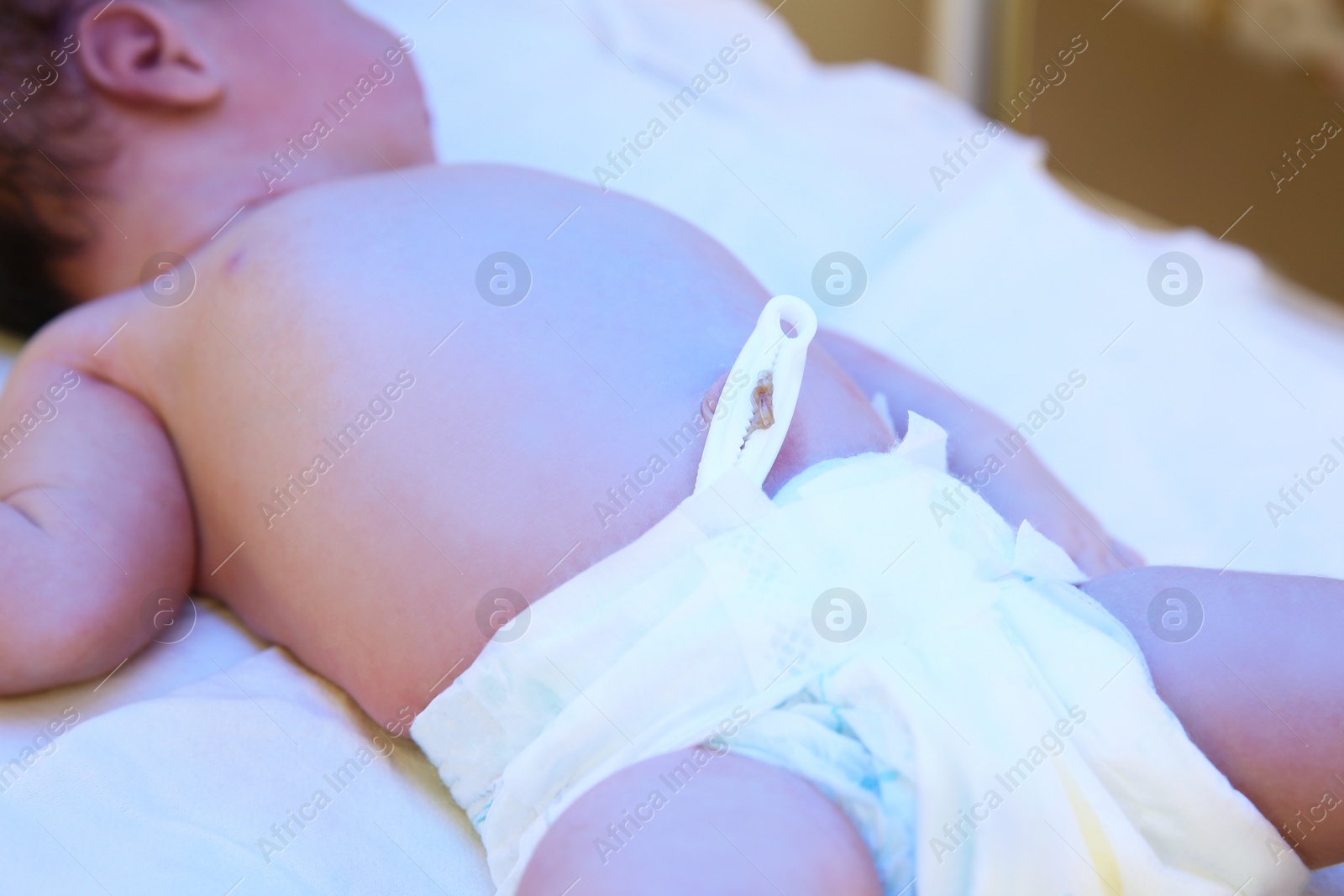 Photo of Newborn child under ultraviolet light in hospital, closeup