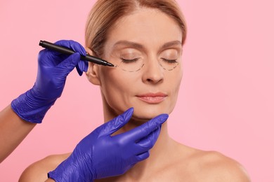 Photo of Doctor with marker preparing patient for cosmetic surgery operation on pink background, closeup