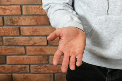 Photo of Man suffering from calluses on hand near brick wall, closeup