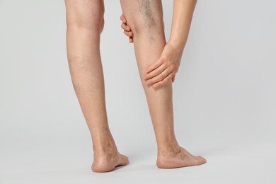 Photo of Closeup view of woman suffering from varicose veins on light background