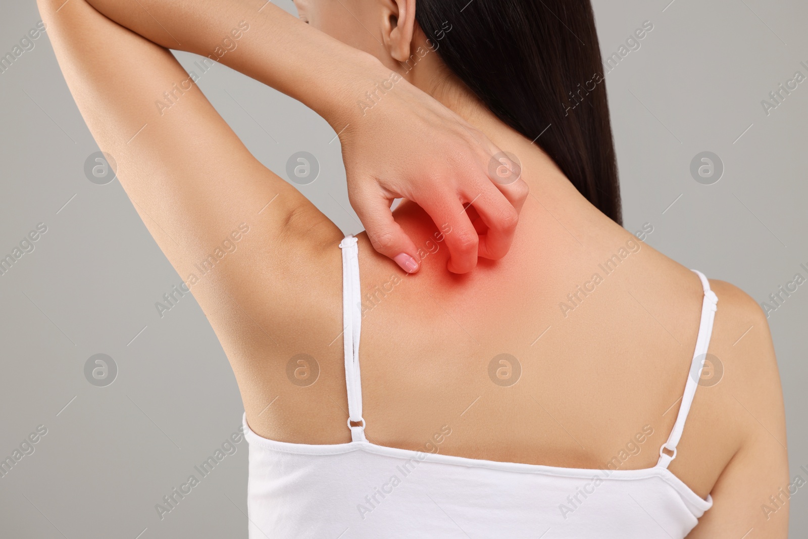 Photo of Suffering from allergy. Young woman scratching her skin on light grey background, back view