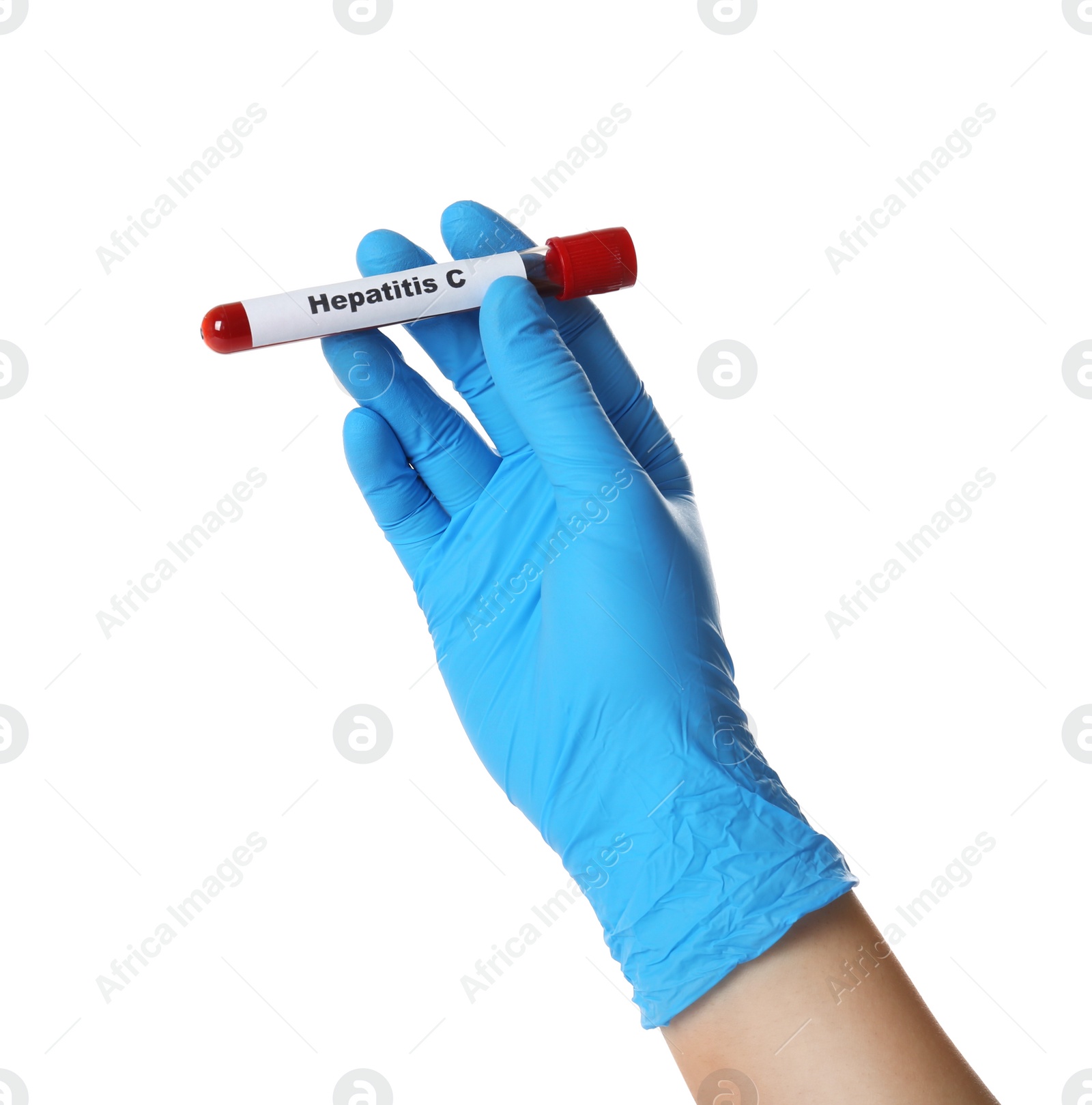 Photo of Scientist holding tube with blood sample and label Hepatitis C on white background, closeup