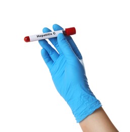 Scientist holding tube with blood sample and label Hepatitis C on white background, closeup