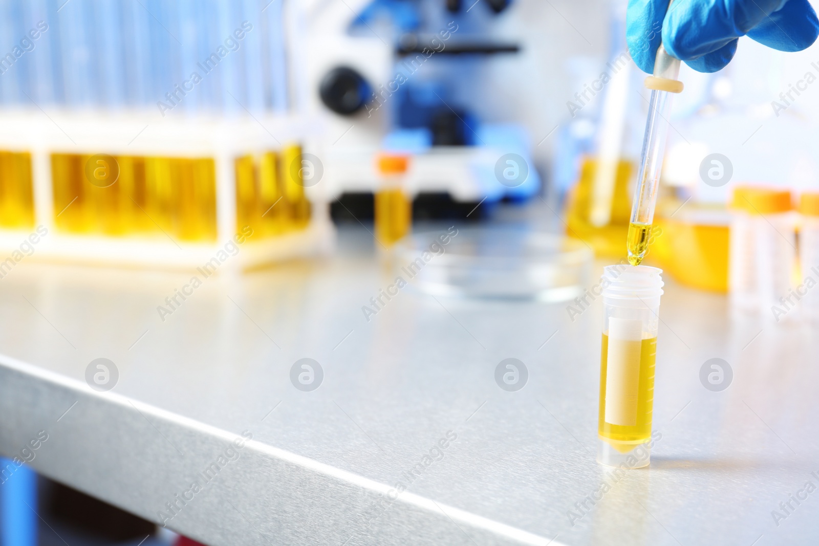 Photo of Laboratory assistant dripping urine sample from pipette into container on table, closeup with space for text. Medical analysis