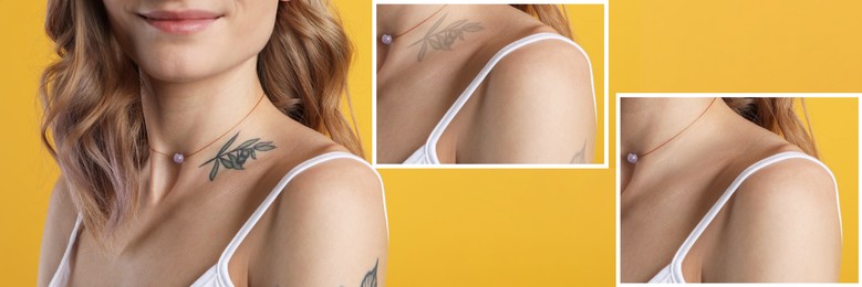 Image of Woman before and after laser tattoo removal procedures on yellow background, closeup. Collage with photos, banner design