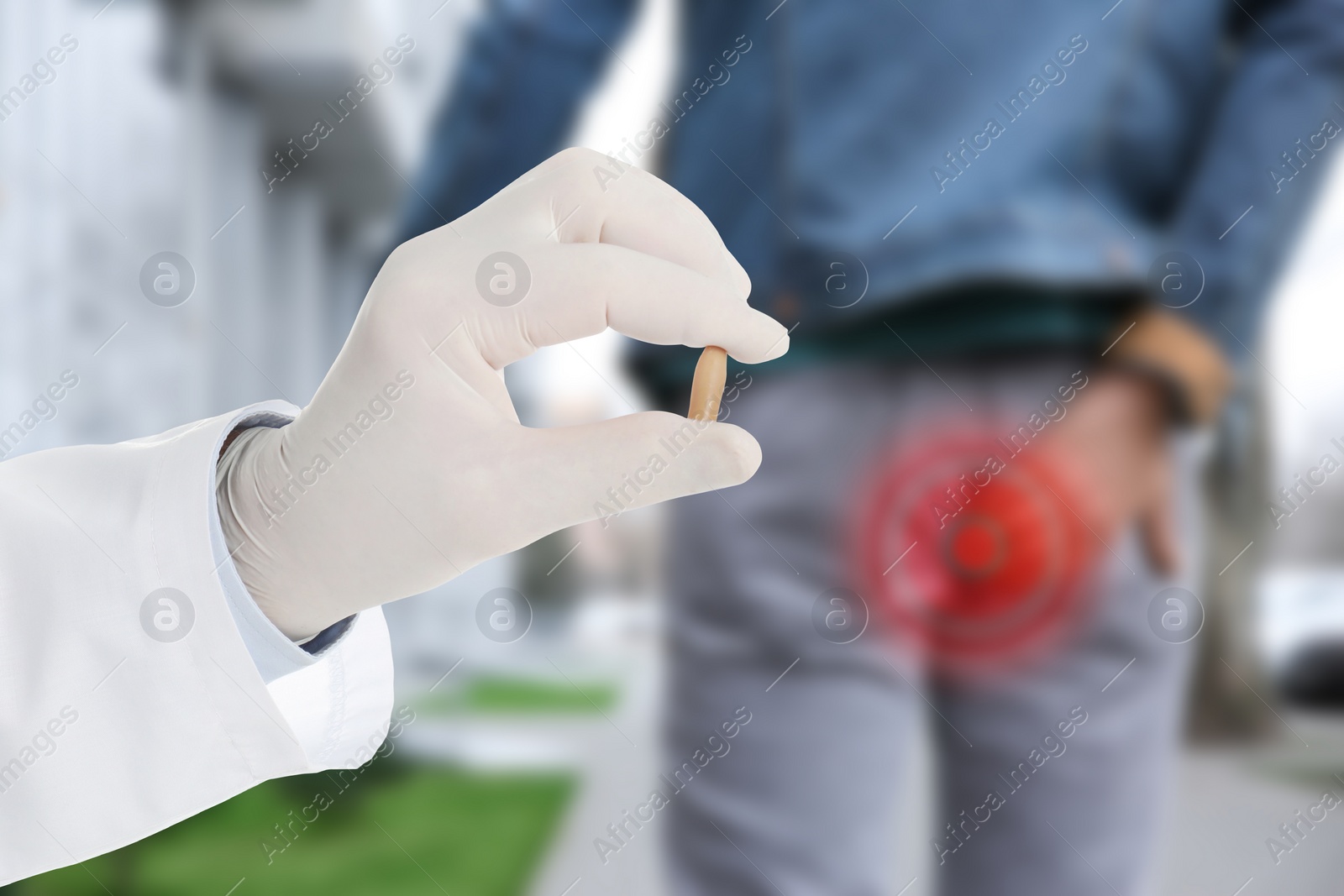Image of Doctor holding suppository for hemorrhoid treatment and man suffering from pain, closeup