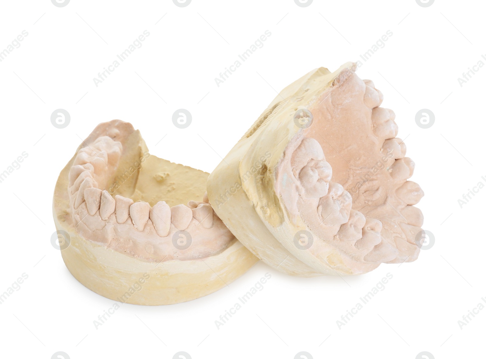 Photo of Dental model with jaws isolated on white. Cast of teeth