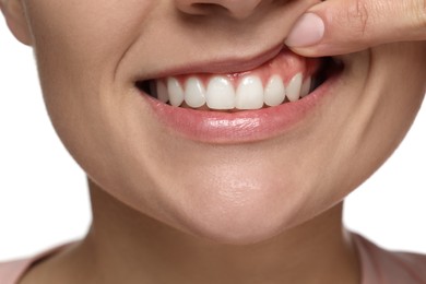 Photo of Woman showing healthy gums on white background, closeup