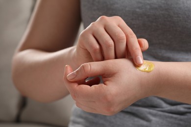 Photo of Woman applying ointment onto her hand indoors, closeup